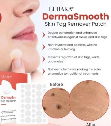 Skin Tag Remover Patch 50% Off